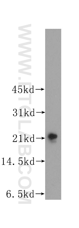 Western Blot (WB) analysis of mouse brain tissue using TAGLN3 Polyclonal antibody (12246-1-AP)