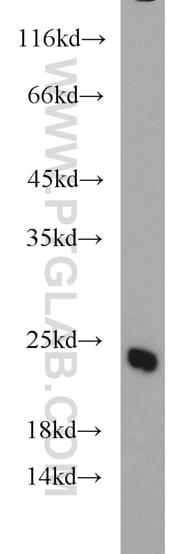 Western Blot (WB) analysis of mouse brain tissue using TAGLN3 Polyclonal antibody (12246-1-AP)