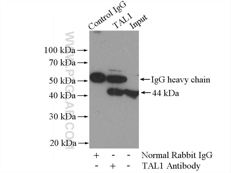 Immunoprecipitation (IP) experiment of Raji cells using TAL1 Polyclonal antibody (55317-1-AP)