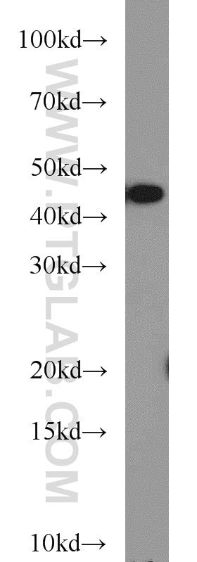 Western Blot (WB) analysis of Raji cells using TAL1 Polyclonal antibody (55317-1-AP)