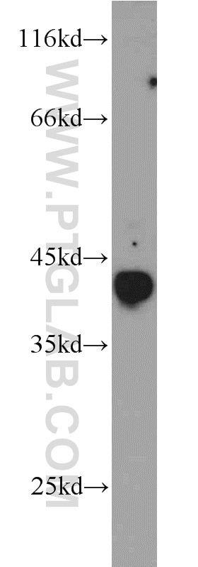 Western Blot (WB) analysis of Jurkat cells using TAL1 Polyclonal antibody (55317-1-AP)