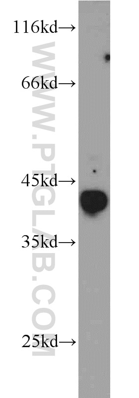 WB analysis of Jurkat using 55317-1-AP