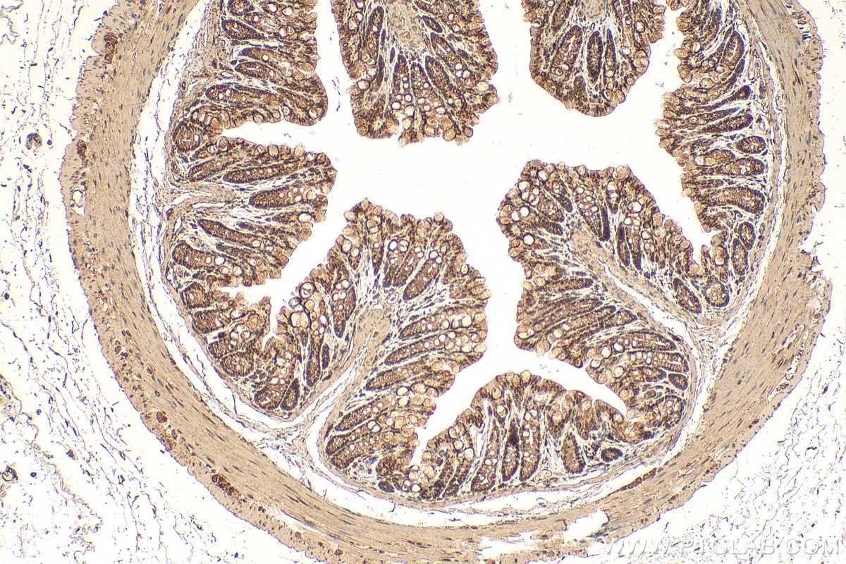 Immunohistochemical analysis of paraffin-embedded mouse colon tissue slide using 12376-1-AP (TALDO1 antibody) at dilution of 1:200 (under 10x lens). Heat mediated antigen retrieval with Tris-EDTA buffer (pH 9.0). Immunohistochemistry (IHC) staining of mouse colon tissue using TALDO1 Polyclonal antibody (12376-1-AP)