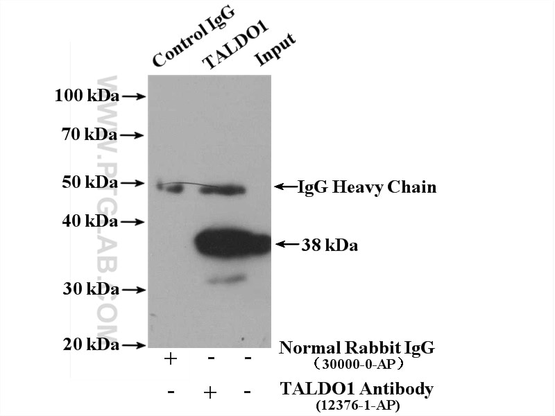 Immunoprecipitation (IP) experiment of COLO 320 cells using TALDO1 Polyclonal antibody (12376-1-AP)