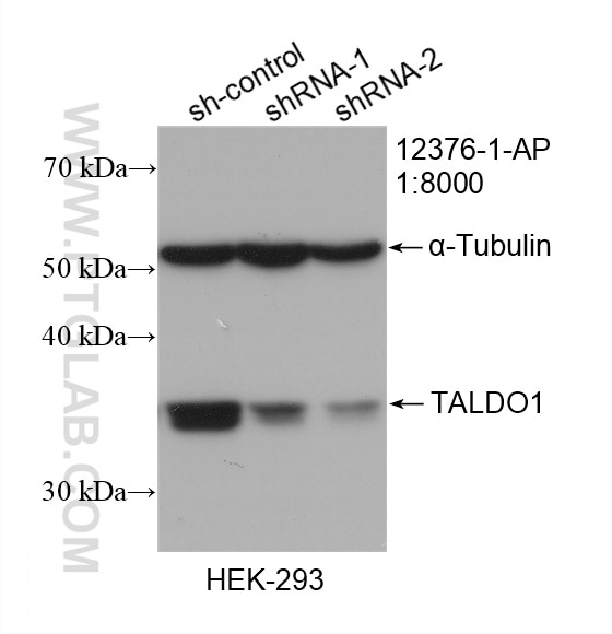 Western Blot (WB) analysis of HEK-293 cells using TALDO1 Polyclonal antibody (12376-1-AP)