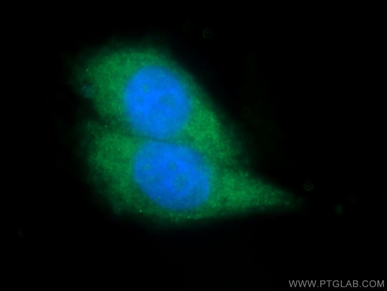 Immunofluorescence (IF) / fluorescent staining of HeLa cells using TAOK1 Polyclonal antibody (26250-1-AP)