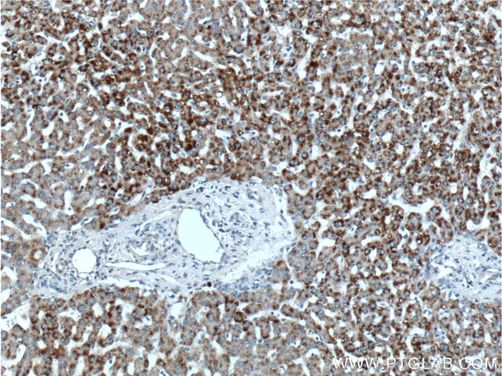 Immunohistochemistry (IHC) staining of human liver tissue using TAOK1 Polyclonal antibody (26250-1-AP)