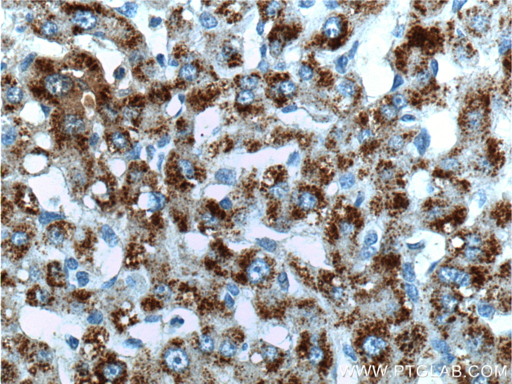 Immunohistochemistry (IHC) staining of human liver tissue using TAOK1 Polyclonal antibody (26250-1-AP)