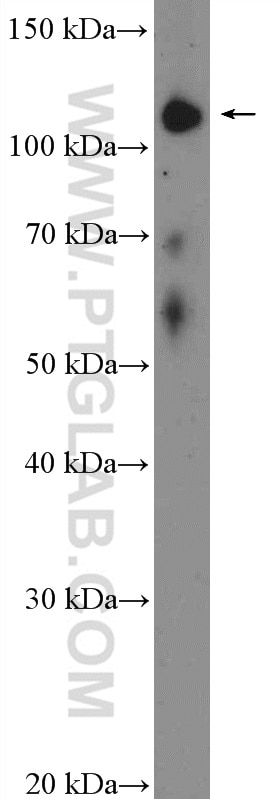 Western Blot (WB) analysis of mouse testis tissue using TAOK1 Polyclonal antibody (26250-1-AP)