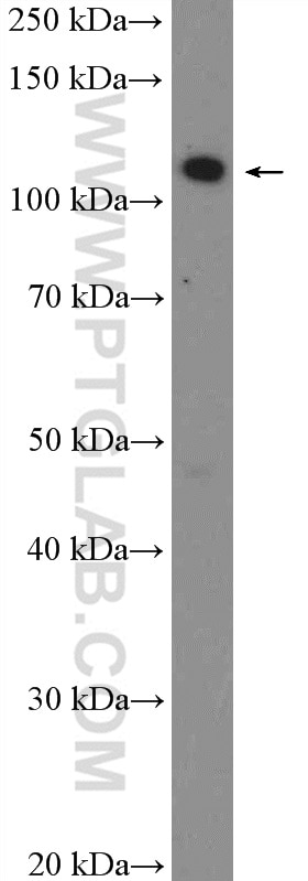 Western Blot (WB) analysis of HeLa cells using TAOK1 Polyclonal antibody (26250-1-AP)