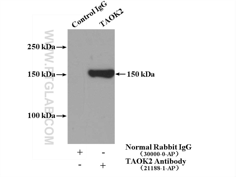 Immunoprecipitation (IP) experiment of HEK-293 cells using TAOK2 Polyclonal antibody (21188-1-AP)