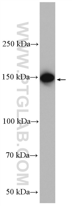 Western Blot (WB) analysis of mouse brain tissue using TAOK2 Polyclonal antibody (21188-1-AP)