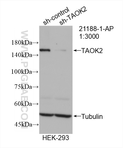 Western Blot (WB) analysis of HEK-293 cells using TAOK2 Polyclonal antibody (21188-1-AP)
