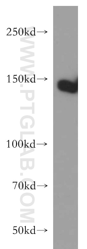 Western Blot (WB) analysis of HEK-293 cells using TAOK2 Polyclonal antibody (21188-1-AP)