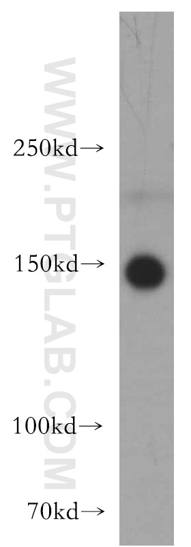 Western Blot (WB) analysis of mouse brain tissue using TAOK2 Polyclonal antibody (21188-1-AP)