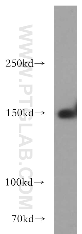 Western Blot (WB) analysis of L02 cells using TAOK2 Polyclonal antibody (21188-1-AP)