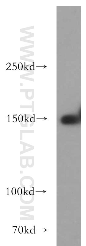 WB analysis of L02 using 21188-1-AP