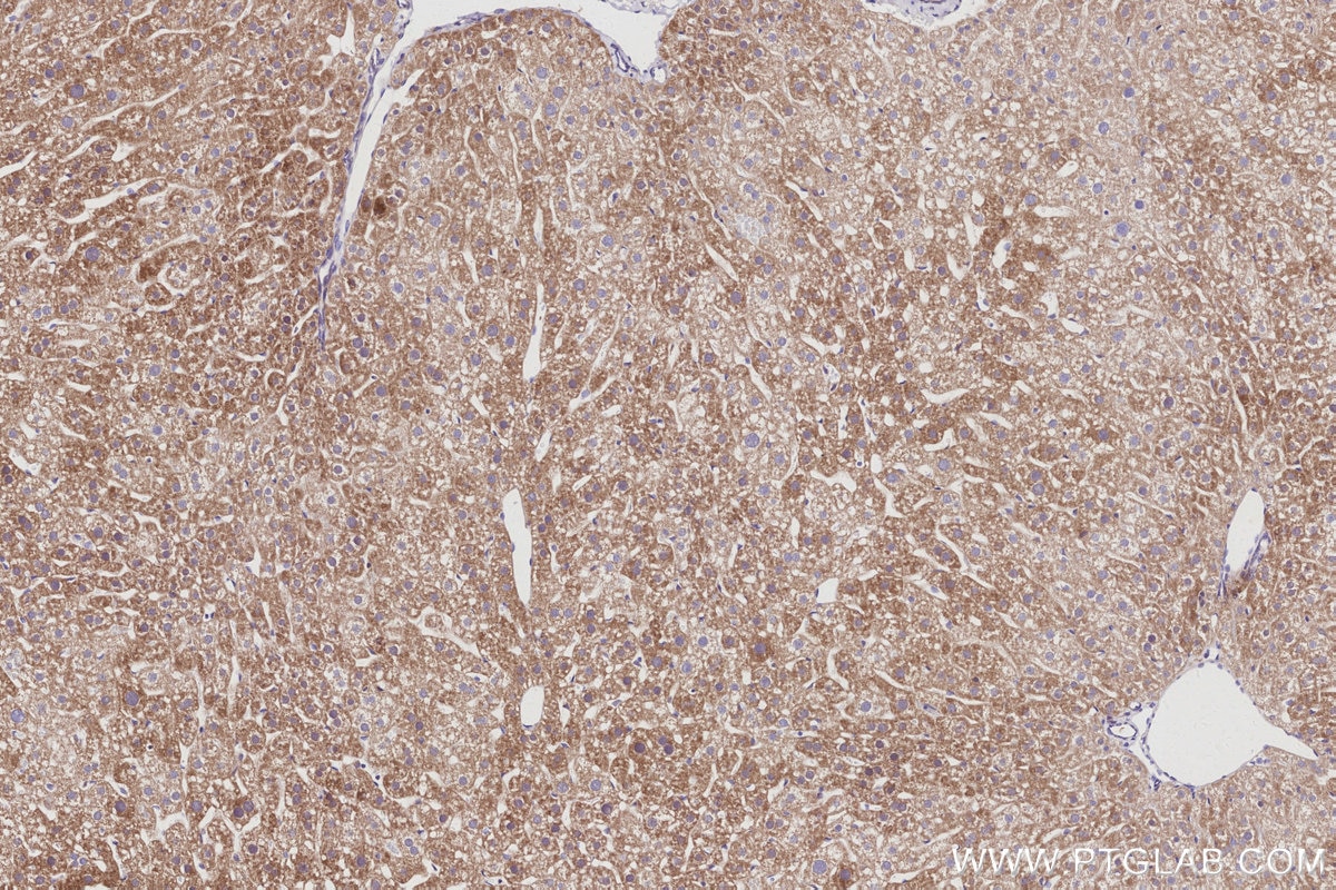 IHC staining of mouse liver using 86221-1-RR Immunohistochemistry (IHC) staining of mouse liver tissue using TAOK2 Recombinant monoclonal antibody (86221-1-RR)