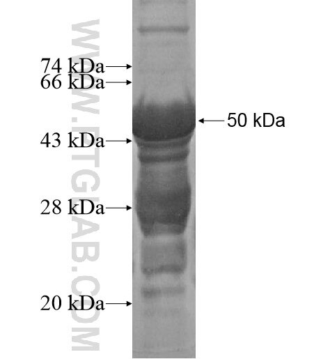 TAOK2 fusion protein Ag15521 SDS-PAGE