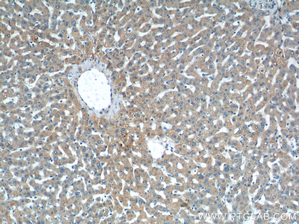 Immunohistochemistry (IHC) staining of human liver tissue using TAOK3 Polyclonal antibody (10158-2-AP)