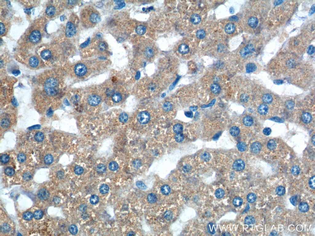 Immunohistochemistry (IHC) staining of human liver tissue using TAOK3 Polyclonal antibody (10158-2-AP)