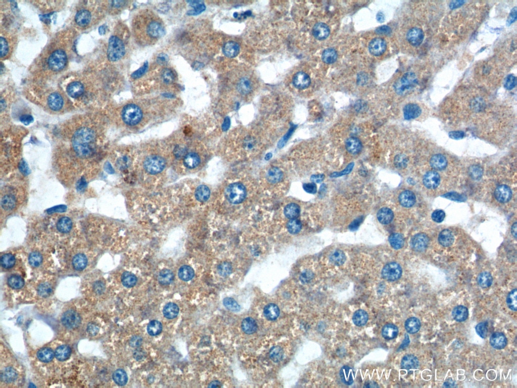 IHC staining of human liver using 10158-2-AP