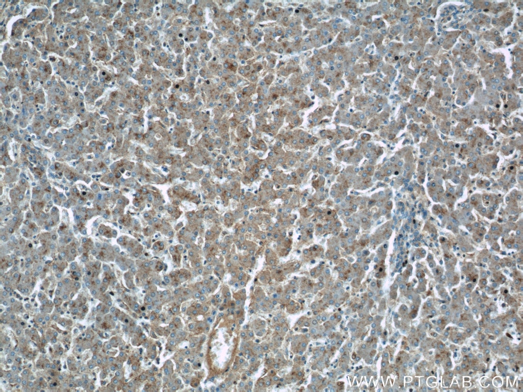 Immunohistochemistry (IHC) staining of human liver tissue using TAOK3 Polyclonal antibody (10158-2-AP)