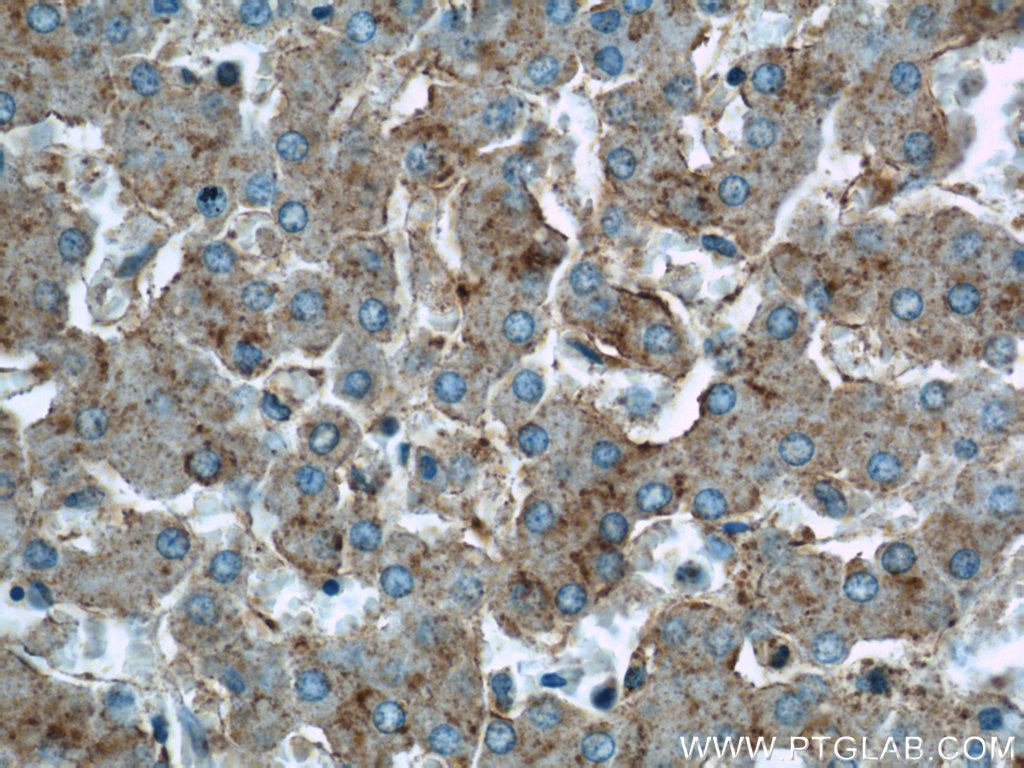 Immunohistochemistry (IHC) staining of human liver tissue using TAOK3 Polyclonal antibody (10158-2-AP)