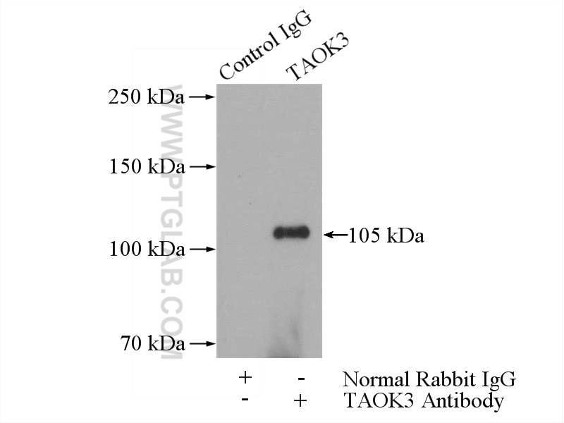 Immunoprecipitation (IP) experiment of HepG2 cells using TAOK3 Polyclonal antibody (10158-2-AP)