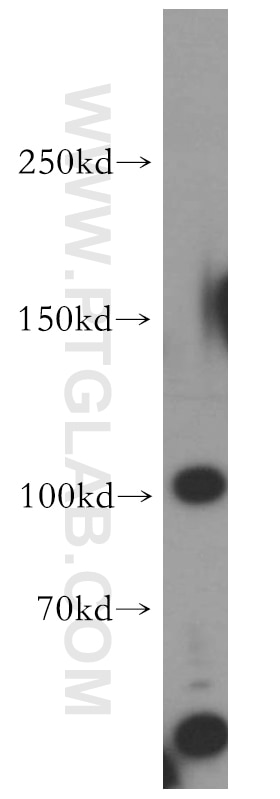 Western Blot (WB) analysis of HeLa cells using TAOK3 Polyclonal antibody (10158-2-AP)