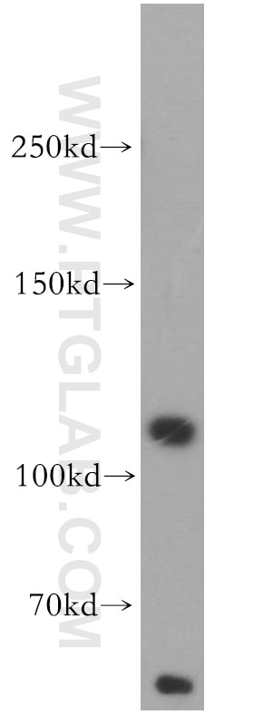 Western Blot (WB) analysis of HepG2 cells using TAOK3 Polyclonal antibody (10158-2-AP)