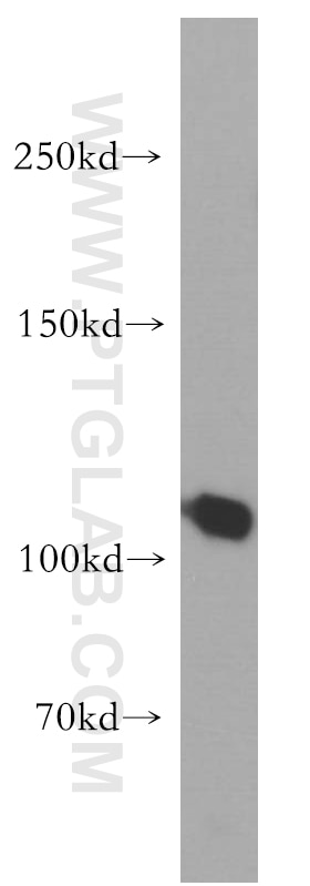 Western Blot (WB) analysis of human liver tissue using TAOK3 Polyclonal antibody (10158-2-AP)