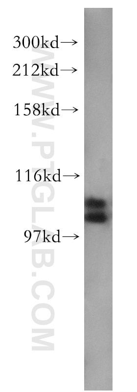 Western Blot (WB) analysis of human brain tissue using TAOK3 Polyclonal antibody (10158-2-AP)