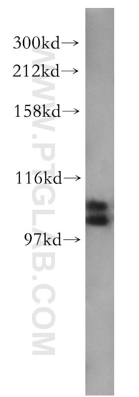 WB analysis of human brain using 10158-2-AP