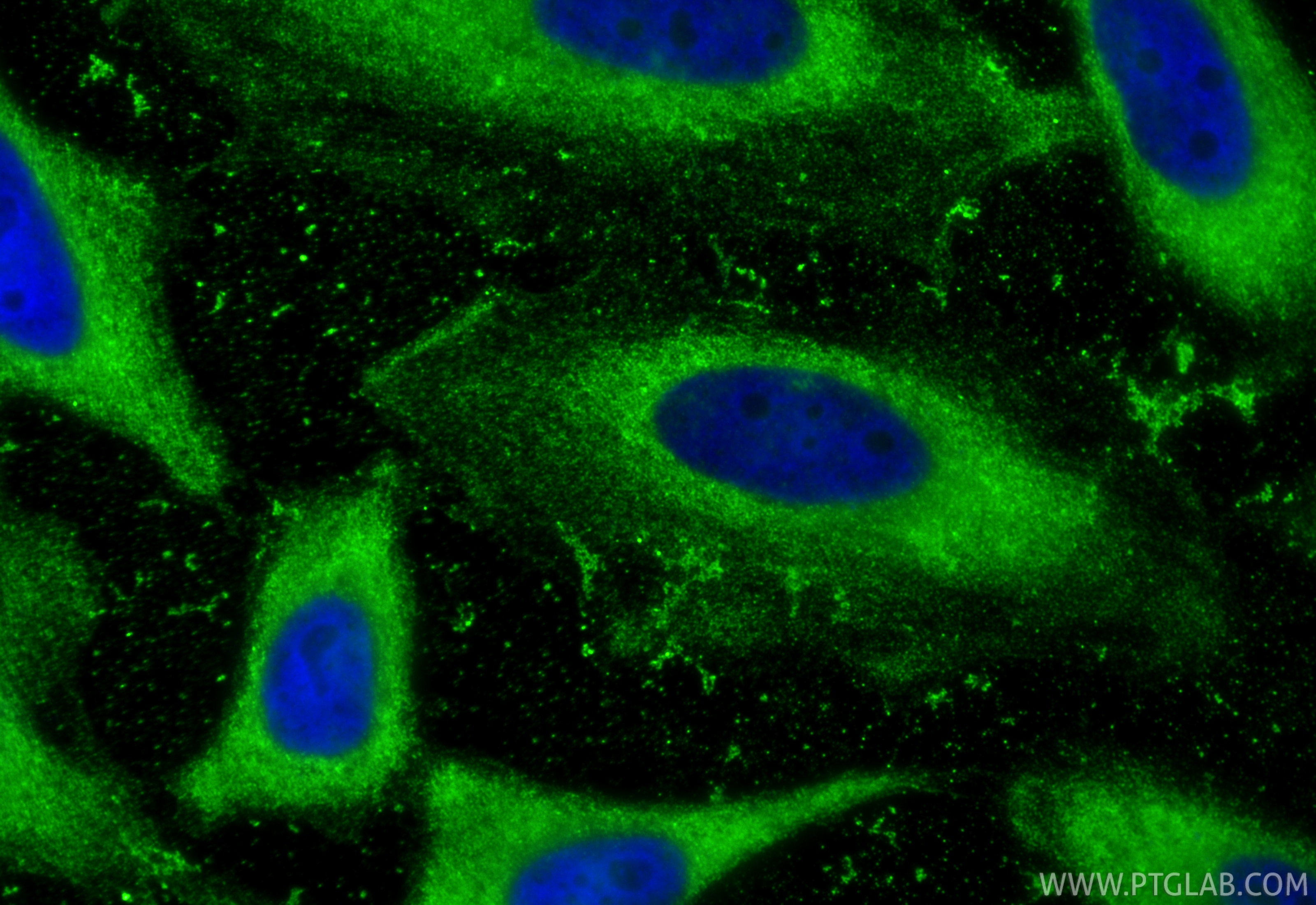 Immunofluorescence (IF) / fluorescent staining of HeLa cells using TAOK3 Monoclonal antibody (67451-1-Ig)