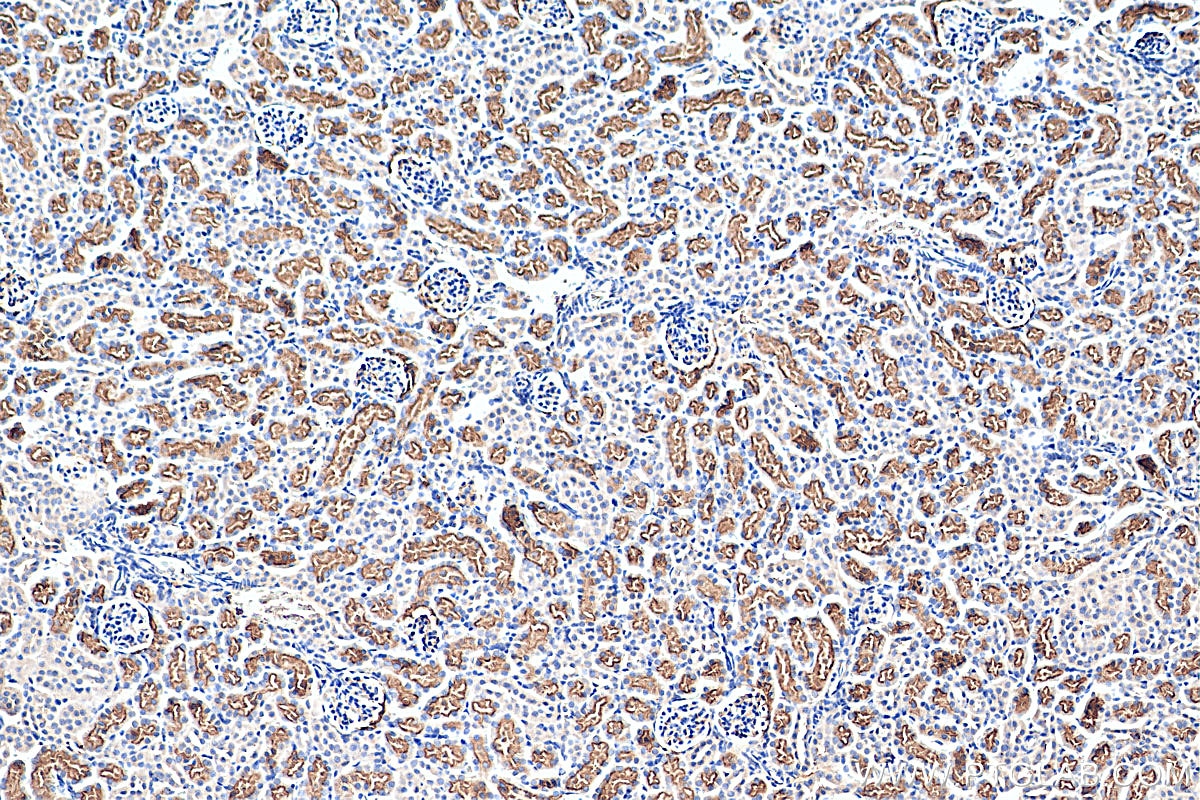 Immunohistochemistry (IHC) staining of mouse kidney tissue using TAOK3 Monoclonal antibody (67451-1-Ig)