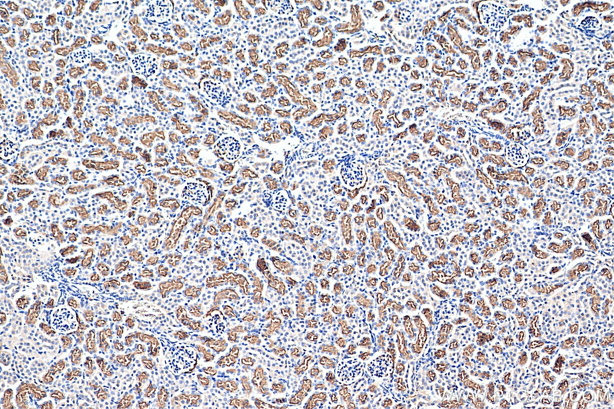 Immunohistochemistry (IHC) staining of mouse kidney tissue using TAOK3 Monoclonal antibody (67451-1-Ig)