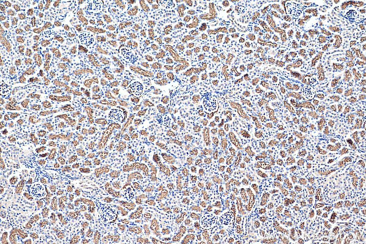 Immunohistochemistry (IHC) staining of mouse kidney tissue using TAOK3 Monoclonal antibody (67451-1-Ig)