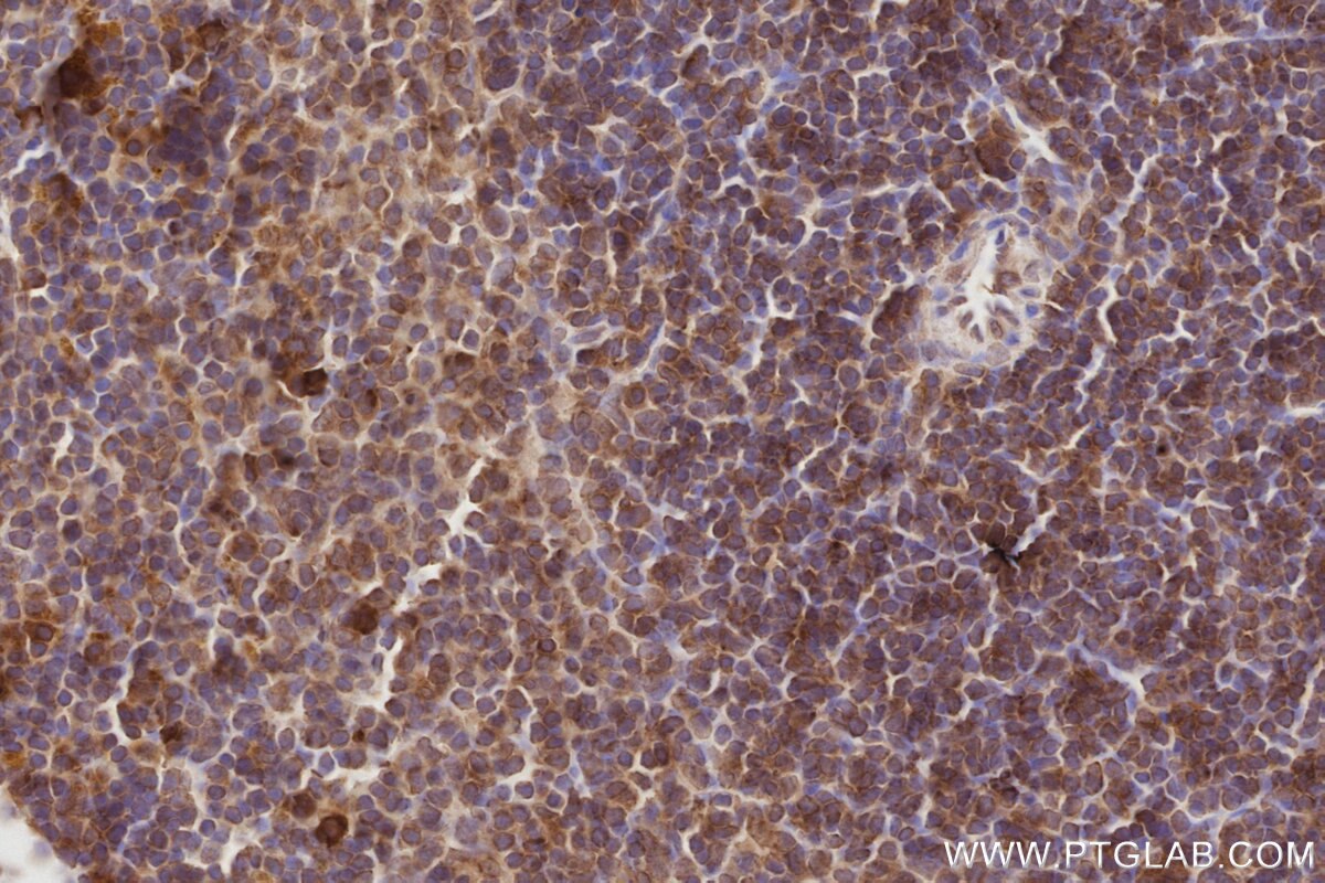 Immunohistochemistry (IHC) staining of mouse spleen tissue using TAOK3 Monoclonal antibody (67451-1-Ig)
