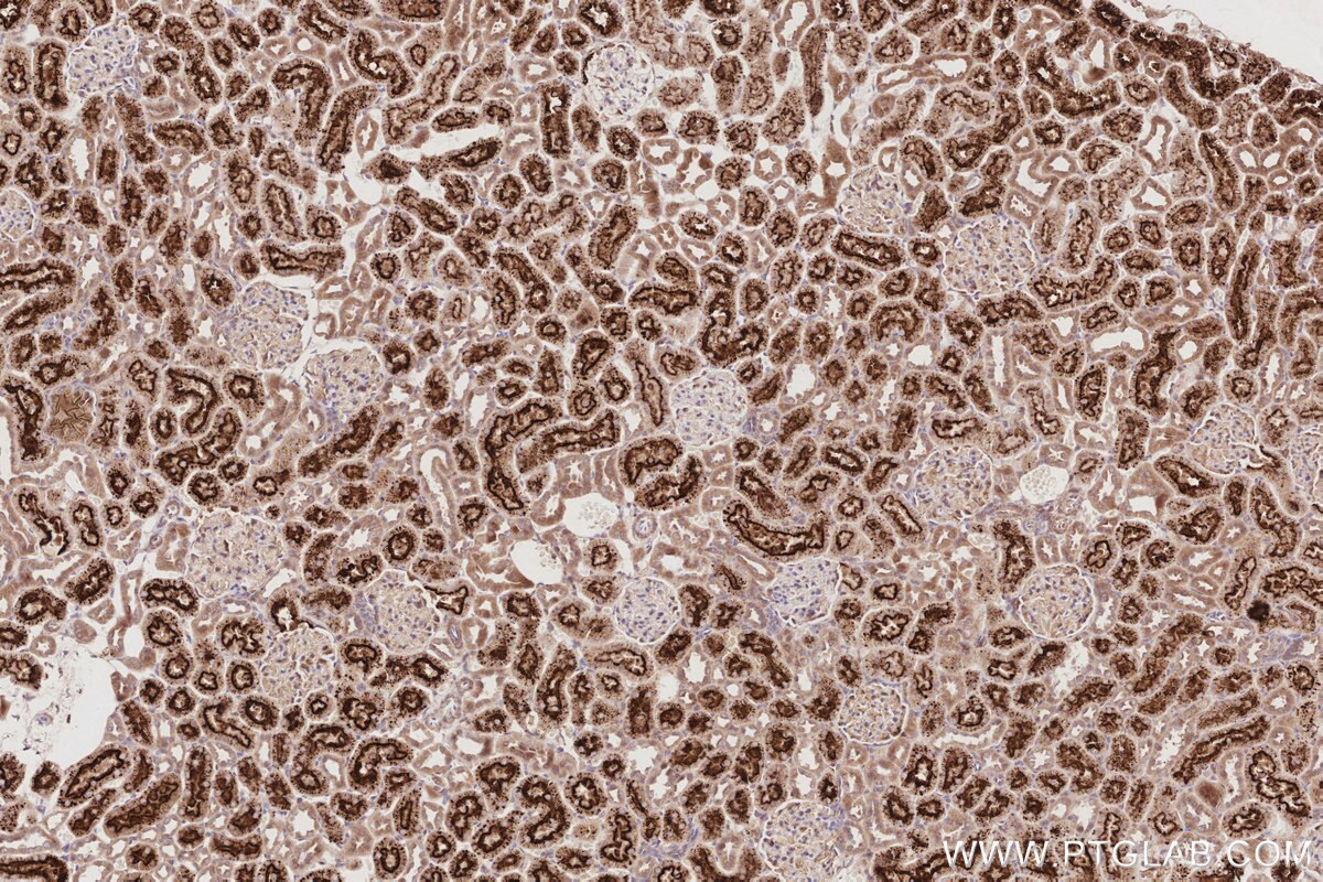 Immunohistochemistry (IHC) staining of rat kidney tissue using TAOK3 Monoclonal antibody (67451-1-Ig)