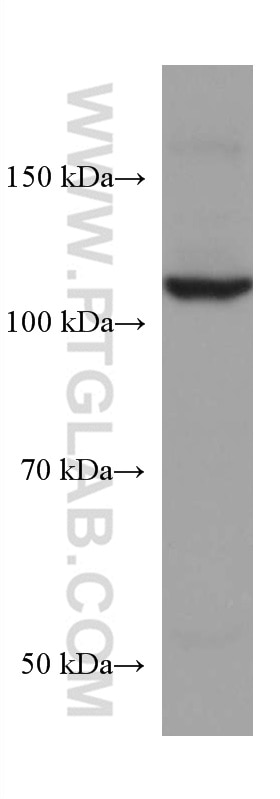 Western Blot (WB) analysis of Jurkat cells using TAOK3 Monoclonal antibody (67451-1-Ig)