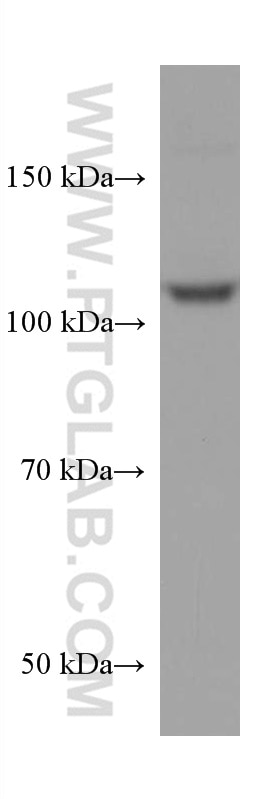 WB analysis of HepG2 using 67451-1-Ig