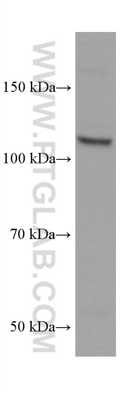 Western Blot (WB) analysis of HeLa cells using TAOK3 Monoclonal antibody (67451-1-Ig)