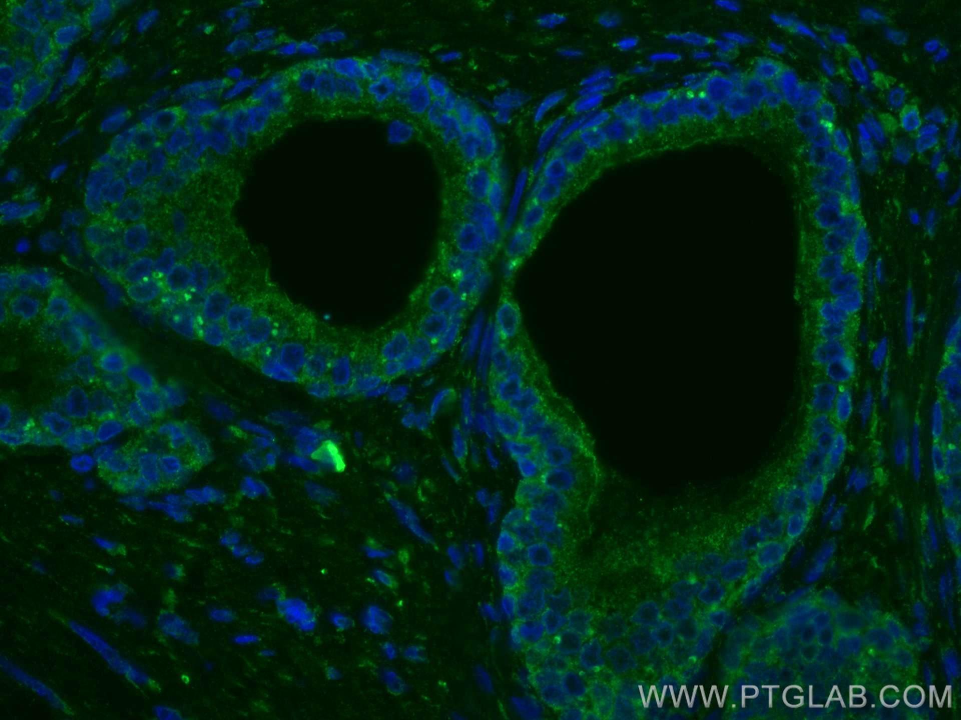IF Staining of human prostate cancer using CL488-67451