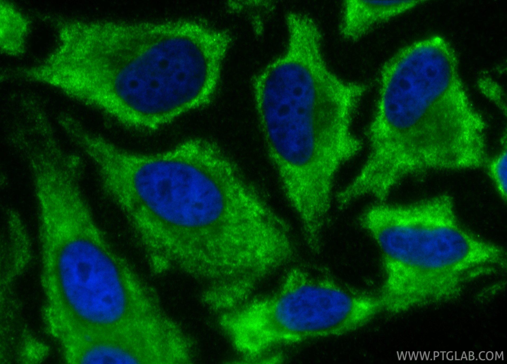 Immunofluorescence (IF) / fluorescent staining of HeLa cells using CoraLite® Plus 488-conjugated TAOK3 Monoclonal ant (CL488-67451)