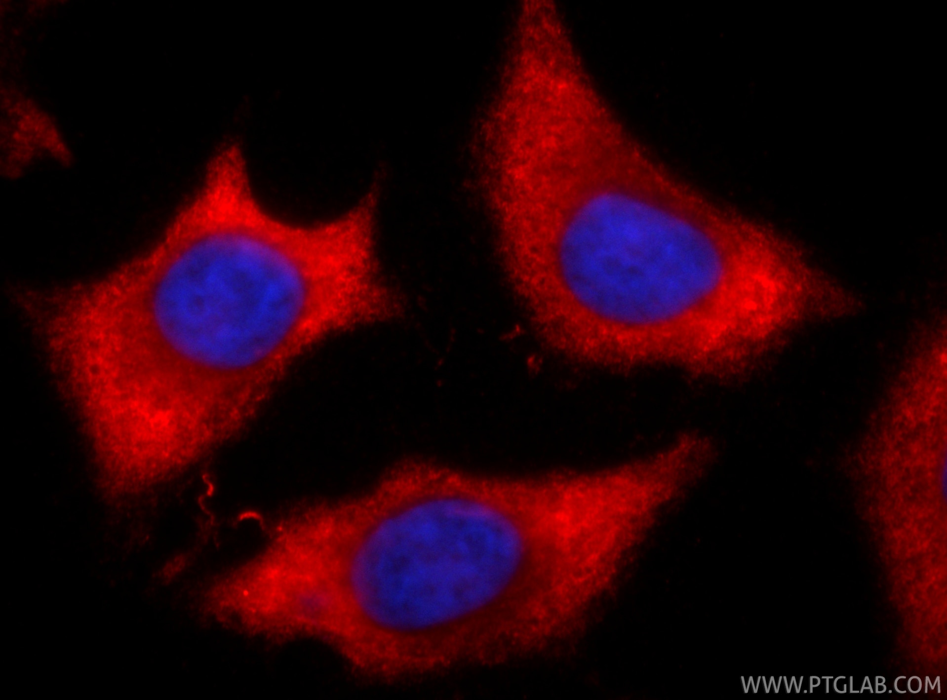 IF Staining of HeLa using CL594-67451 Immunofluorescence (IF) / fluorescent staining of HeLa cells using CoraLite®594-conjugated TAOK3 Monoclonal antibody (CL594-67451)