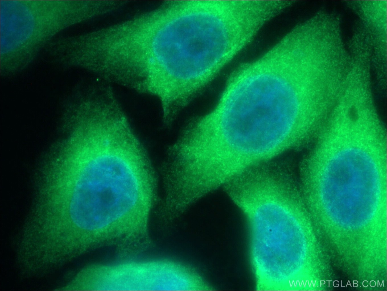 Immunofluorescence (IF) / fluorescent staining of HepG2 cells using TAP1 Polyclonal antibody (11114-1-AP)