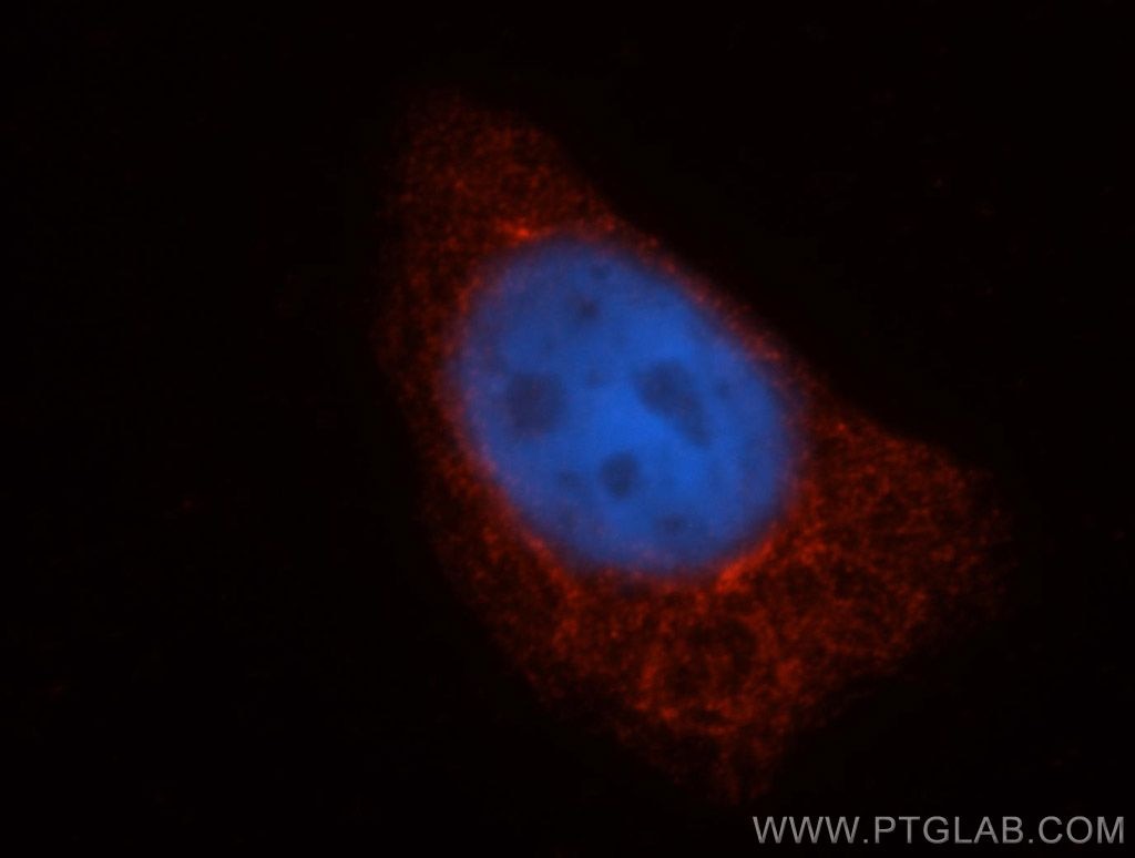 Immunofluorescence (IF) / fluorescent staining of HepG2 cells using TAP1 Polyclonal antibody (11114-1-AP)