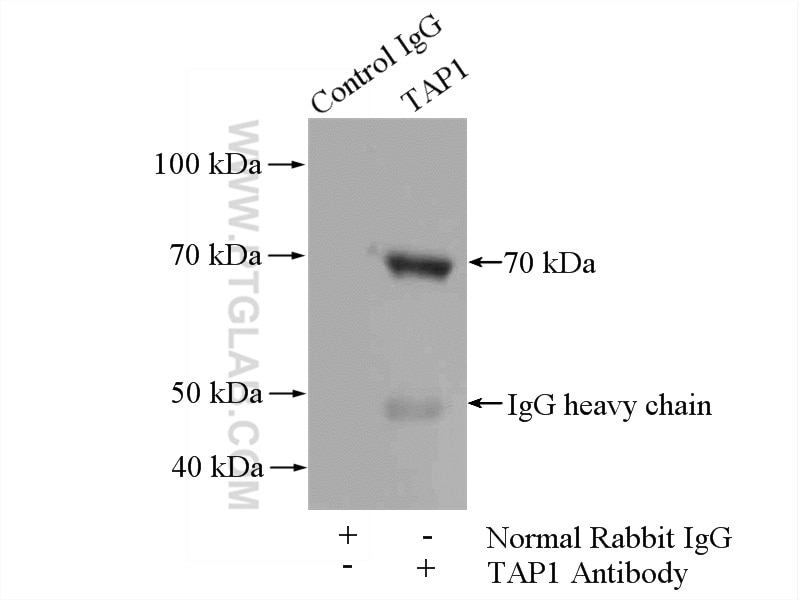 Immunoprecipitation (IP) experiment of HepG2 cells using TAP1 Polyclonal antibody (11114-1-AP)