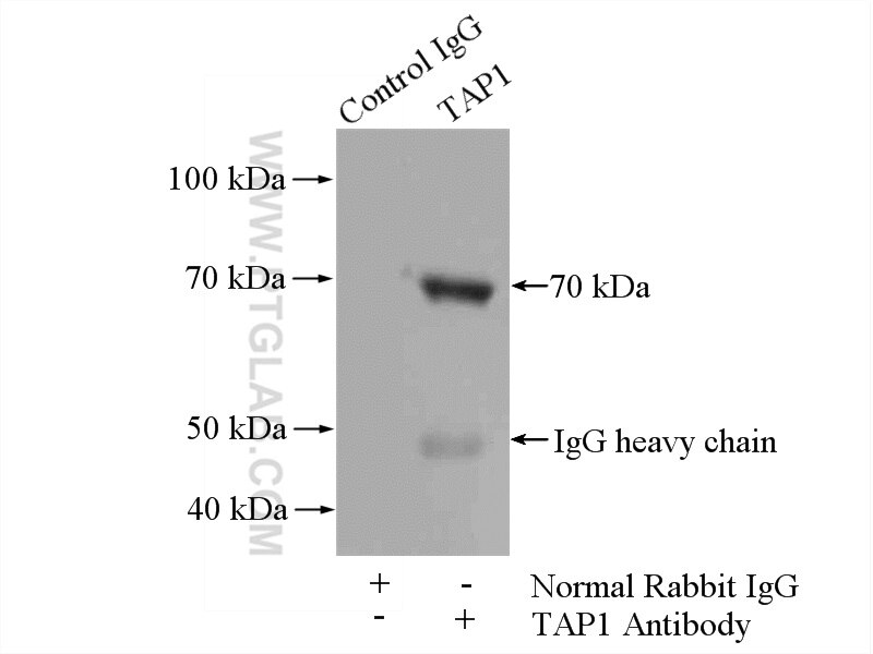 IP experiment of HepG2 using 11114-1-AP